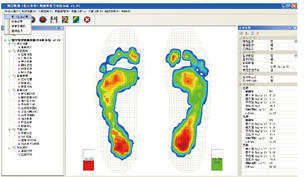 足底壓力分布測試系統(tǒng)